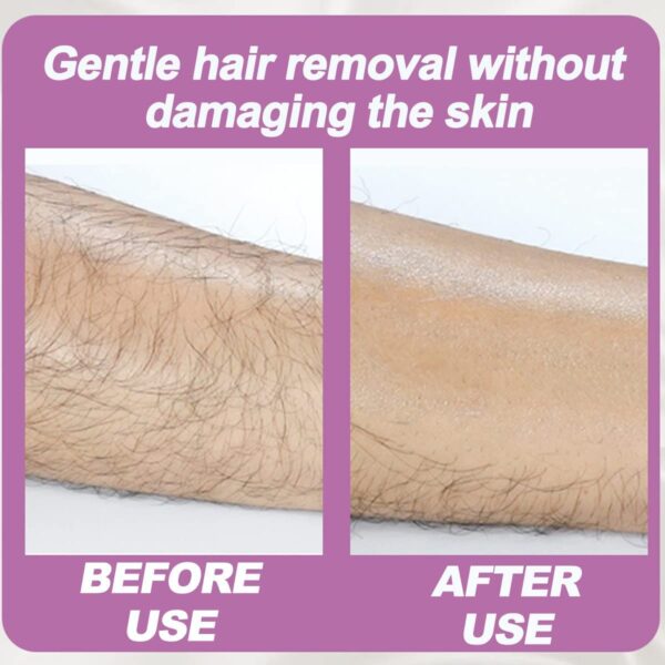 Crystal Hair Removal - Image 4